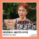 호텔오비탈 | 청담 튠페이스와 콜라겐주사 결절 부작용 없이 팔자주름 개선한 스컬트라 후기