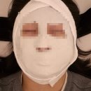 한피부과의원 | [대전] 톤즈의원 피부과 솔직 후기 (점 제거 + 아쿠아필)