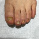 매료네일 문제성전문점 이미지