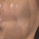 써니존 사우나 | [동안에스테틱 부산 동래명륜본점] 동래역근처 피부관리추천