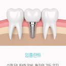 더웃는치과의원 이미지