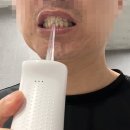 덴탈리어 이미지