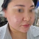 윤정분 스킨케어