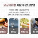 닭살이야 이미지