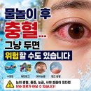 송탄성모안과의원 네이버블로그
