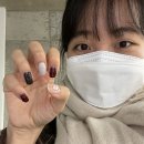 고은의원 | 여러분 저.. 쌍수했어욧!! 내돈내산 쌍수후기/영통 고은미인의원/추천추천/눈커짐