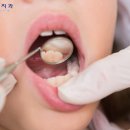 풍무치과 네이버블로그