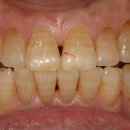 앵글치과의원 이미지