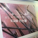 건강한밥상 동인천점 | 인천 두피관리 전문, 두피밥 인천점 남자친구 탈모 관리 후기
