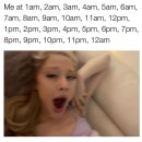 시온메디 | 읏추