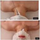 리바디바이에너지테라피 | 리바디 바이 에너지테라피 내돈내산 신부관리 후기