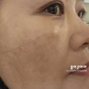(주)가양산업 | 가양역피부관리 미플 가양점에서 받은 맞춤 피부관리 후기