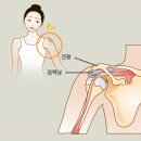 본튼튼마취통증의학과의원 네이버블로그