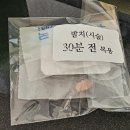 사랑니 발치 후기