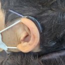 대동 독일보청기 이미지