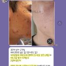 디크림슨