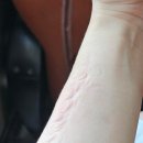 발안한의원 | 내돈내산 쿠팡 제품 후기 합곡혈 손바닥 지압기, 지압깔창