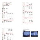 여름방학 | 마지막 발악_대학원생의 첫 여름 방학 후기