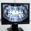 디즈니치과의원 | 드디어 나도 가지런한 치아 겟또!