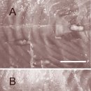 해상 가두리 양식 은연어의 몸통 근육 기생 미포자충 Microsporidium sp. 이미지