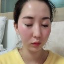 에끌라셀