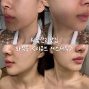 리유에스테틱 - 전주시 완산구 평화8길 8 | [광주 서구] 윤곽은 바로 여기! 화정동 윤곽관리 맛집 화정동<리큐브에스테틱> 광주 웨딩필수코스 솔직후기