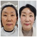 인셀덤부평 | 인셀덤 사용 후기~~