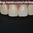 청담치과기공소 이미지