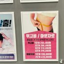 대전약국 | 대전 중구 마운자로 다이어트 처방 병원·약국 후기 및 가격