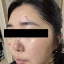 달크림 | 키오스킨 디판테놀 15.5 크림 한 달 후기 | 재구매는 NO, 그래도 3개월은 써봅니다
