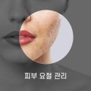 요철 이미지