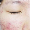 보라사 이미지