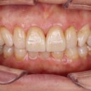 누가치과기공소 이미지