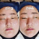 내돈 내산 피부 맛집 ’ 대전슈퍼젝션페이스터치 둔산점 ‘