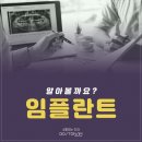 청주산남동치과 임플란트병원 임플란트 식립 미루면 발생하는 문제