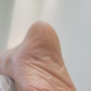 레푸스천안두정점