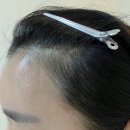 메르뷰아카데미 | 메르뷰 반영구 아카데미 헤어라인 반영구 후기 강남구청 강남본점 내돈내산 후기