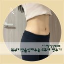복부지방흡입 재수술 5주차 체지방량 -3.9kg 빠지고 복부라인 대박난 리얼 후기