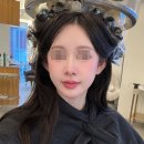 압구정피부과 리니어지리프팅 600샷 후기