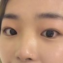 린뷰티 이미지