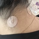 근육통 파스추천 사임당 4000가우스 동전 금도금 자석파스 사용후기