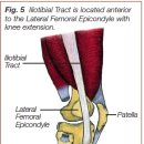 Iliotibial Band Friction Syndrome - 허리, 골반문제의 마지막 해결점. 수련의 몫 이미지