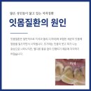 연세남구로치과의원 | 구로구 잇몸치료 체계적인 치료로 증상 개선