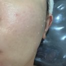 지족동피부관리 프린세스에서 수분관리 받은 후기