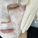 (주)파워소프트 | 광주 플라즈마 상무지구 피부관리 멜로우 소프트 플라즈마 후기