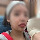 낭낭이네 | 강남역피부과 울쎄라피프라임 킴카다시안이 다녀온 병원 다녀온 후기