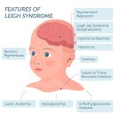 한국보존견보존연합회 | 리 증후군(Leigh Syndrome)