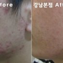 리유한의원 네이버블로그