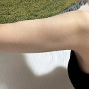 수원전담 | 수원지방분해주사 1:1 서울대의료진전담 상담 관리 부작용 내돈내산 솔직후기