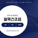 공도탁마취통증의학과의원 | 만정리마취통증의학과, 발목 복사뼈 부근 통증과 압통 '발목건초염', 원인과 증상은?